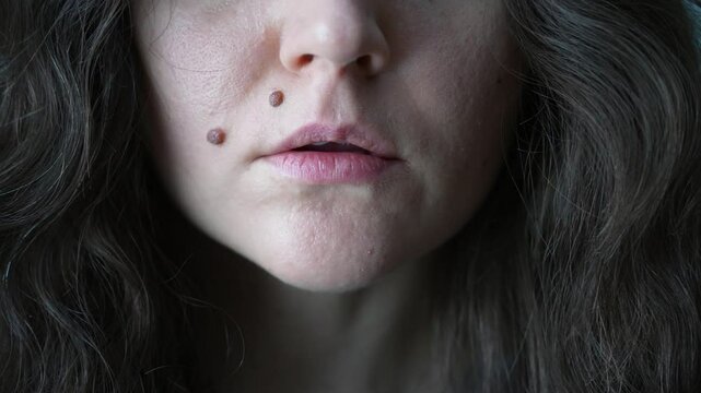 brunette woman close-up of lips and two moles on her face