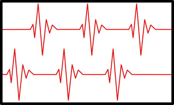 heart bit rate monitoring on white background, medical check heart with EKG, ECG tools measurement. result medical lab