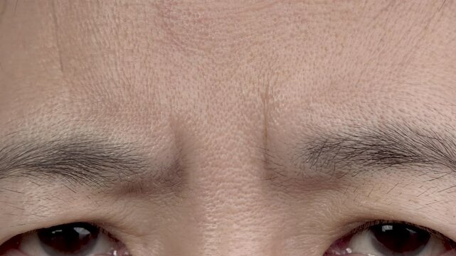 Senior woman worry about crease between her eyebrows.