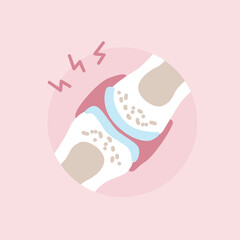An inflamed joint in pain. Rheumatoid Arthritis. Vector illustration in flat style.