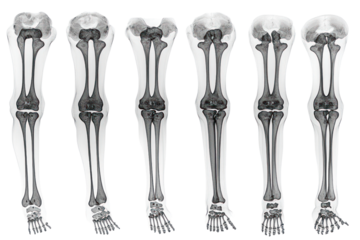 Leg Bones X-Ray Variations: Seven detailed X-ray images showcase variations in human leg bones, offering a comprehensive view for medical, anatomical, or educational purposes.