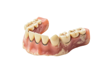 Tooth implant procedure for missing teeth, long-term replacement solution isolated on transparent and white background.PNG image