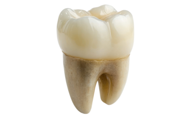 Tooth implant procedure for missing teeth, long-term replacement solution isolated on transparent and white background.PNG image