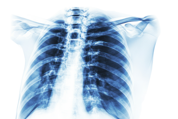 X-ray of Human Chest: A detailed X-ray image revealing the intricate structure of the human chest, showcasing the ribs, spine, and lungs in a medical illustration.  