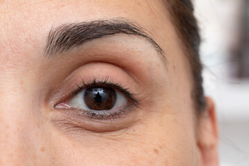 Woman showing crow's feet and dark circles under eye with makeup