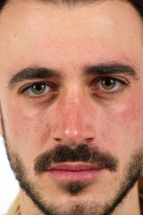 Obraz premium Close-up portrait of a young man showing facial redness and irritation