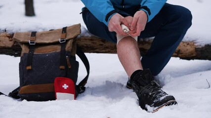 Hiker wrapping bandage around injured leg in a snowy forest, near backpack and first aid kit, focusing on self-care and safety during outdoor activities