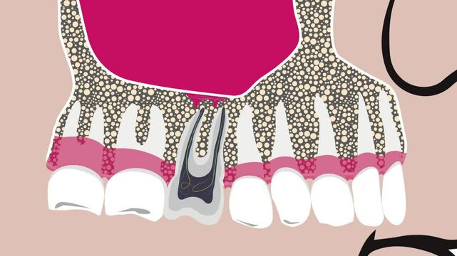 tooth trauma