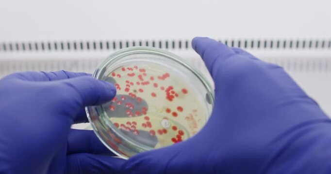 Red yeast colonies on a petri dish, scientist compares bacteria on petri dishes.