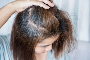 closeup of woman highlighting thinning hair, damaged strands, and grey roots from chemical...