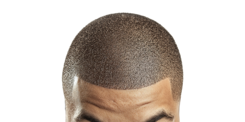 Close-up of male shaved head isolated on transparent background