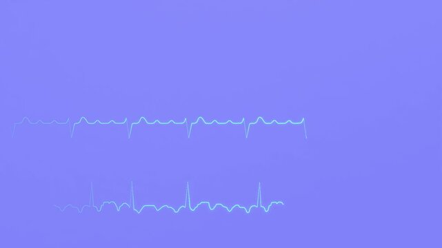 Is The Rto R Regular In A Flutter