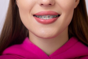 Close-up of a smiling woman with dental braces on a pink background.