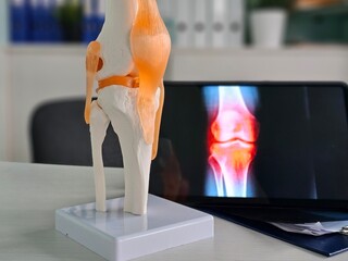 Model of a human knee joint with highlighted MRI scan displayed on a screen