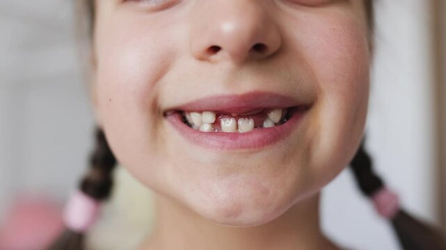 Portrait of smiling Caucasian girl with missing teeth, showing gap from falling out baby teeth at home. Brown hair in pigtails, representing childhood and tooth loss.