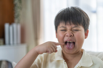 Asian boy showing red rash and blisters on mouth symptoms of hand foot mouth disease skin irritation, childhood health condition infectious disease awareness medical care and prevention concept