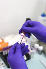 A tube with blood is placed in a tray for blood tests.