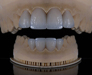 Computer-aided smile design treatment with porcelain crowns in digital dental dentistry. Digital jaw model with laminate veneers for dental smile design. Smile makeover. © UniqDream
