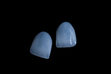 Computer-aided smile design treatment with porcelain crowns in digital dental dentistry. Digital jaw model with laminate veneers for dental smile design. Smile makeover. © UniqDream