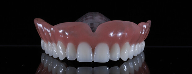 Dental treatment applied for edentulous individuals in dentistry. Dental jaw total prosthesis. Smile makeover.  © UniqDream