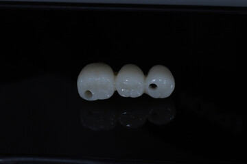 In dental and cosmetic dentistry, bone-anchored dental implant treatment with porcelain bridge prostheses and implant screws.  © UniqDream