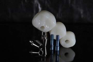 In dental and cosmetic dentistry, bone-anchored dental implant treatment with porcelain bridge prostheses and implant screws.  © UniqDream