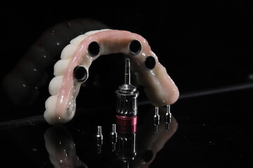 The All-on-4, All-on-X, and All-on-4 treatment concepts in dental implant therapy provide full arch dental prosthesis for completely edentulous jaws. Dental implants are a dentistry treatment placed  © UniqDream