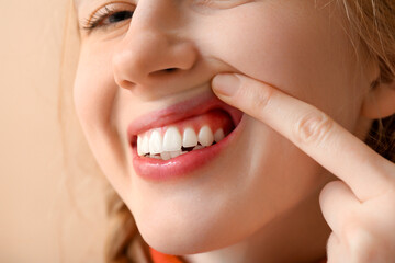 Obraz premium Teenage girl showing teeth on beige background, closeup