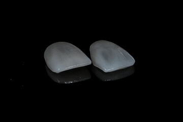 Dental porcelain crowns. Dental laminate veneers in smile design treatment in dentistry. Smile makeover.  © UniqDream