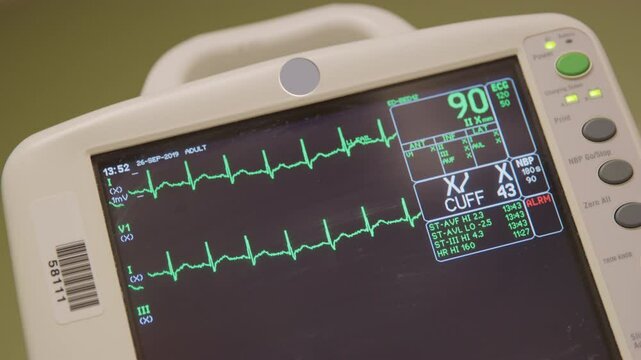 Heart Monitor Screen EKG ECC Close
