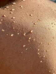 Water droplets glistening on skin after a refreshing swim
