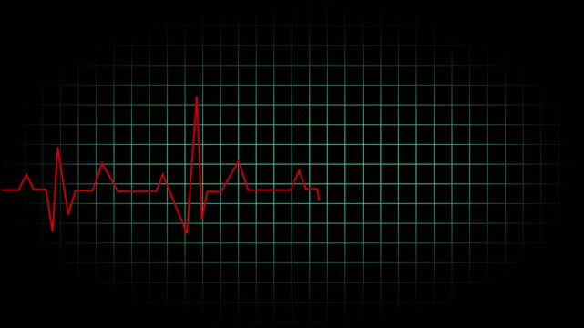 Heartbeat Monitor Screen Video