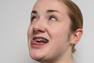 Fototapeta premium Young woman after dental medical care