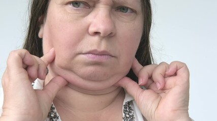 closeup face mature woman 55 years old, human fat neck, gravitational ptosis, double saggy chin, Aging and Facial Appearance, age-related skin changes, cosmetic anti-aging procedures, skin tightening