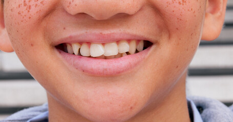Obraz premium Smile, dental and closeup of child in city for happiness, orthodontist and teeth cleaning. Pride, wellness and oral hygiene with zoom of mouth of person in outdoor for confidence, gum care and lips
