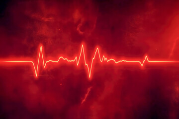 ECG strip showing a rhythm with irregular P waves, QRS complexes, and T waves