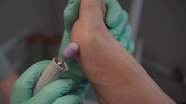 Podiatry treatment of feet. Podiatry doctor in clinic. Podiatry specialist in beauty salon. Feet peeling. Callus removal. Drill machine using drill bits. Pedicure procedure