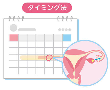 不妊治療　不妊症　タイミング法　印の付いたカレンダー