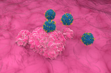 CAR T cell therapy in Bladder cancer - isometric view 3d illustration