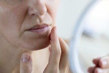 Woman with problem skin in front of mirror. Big pores and wrinkles on the face. Closeup.