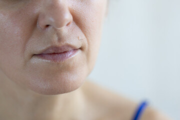 A mole with hair on female face. Closeup.