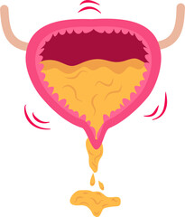 Urinary bladder incontinence