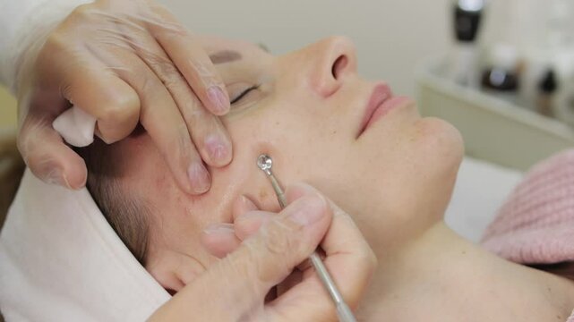 Beautician wearing gloves removes acne from woman face while she lies down, focusing on skin care and hygiene. Beauty Clinic Concept