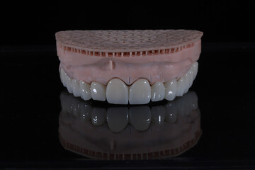 3D-printed jaw model and full-mouth zirconium porcelain crowns. Computer-assisted smile design treatment. dental before after.  © UniqDream