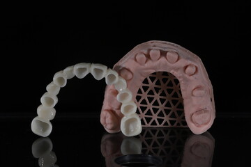 3D-printed jaw model and full-mouth zirconium porcelain crowns. Computer-assisted smile design treatment. dental before after.  © UniqDream