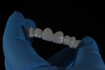 3D-printed jaw model and full-mouth zirconium porcelain crowns. Computer-assisted smile design treatment. dental before after.  © UniqDream