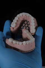3D-printed jaw model and full-mouth zirconium porcelain crowns. Computer-assisted smile design treatment. dental before after.  © UniqDream