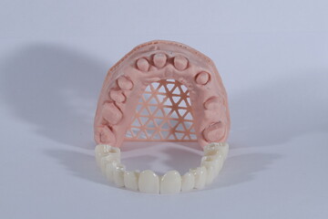 3D-printed jaw model and full-mouth zirconium porcelain crowns. Computer-assisted smile design treatment. dental before after.  © UniqDream