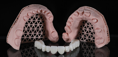Dental zirconium porcelain crowns placed on a digital model. Aesthetic visual with dental smile design. © UniqDream