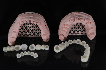 Dental zirconium porcelain crowns placed on a digital model. Aesthetic visual with dental smile design. © UniqDream